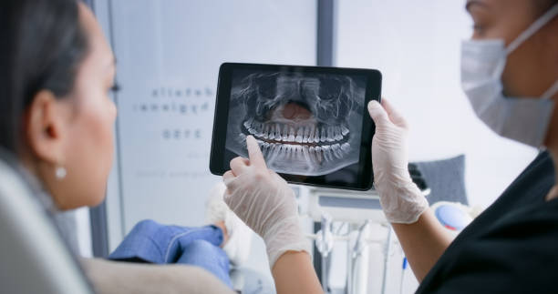 Licensed Teeth Whitening service in Rotan, TX - Smile Center Dentistry